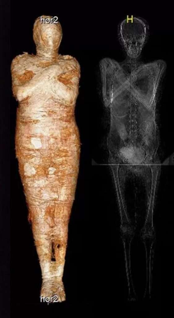 ‘Rebirth afterlife’: Polish scientists discover first pregnant mummy