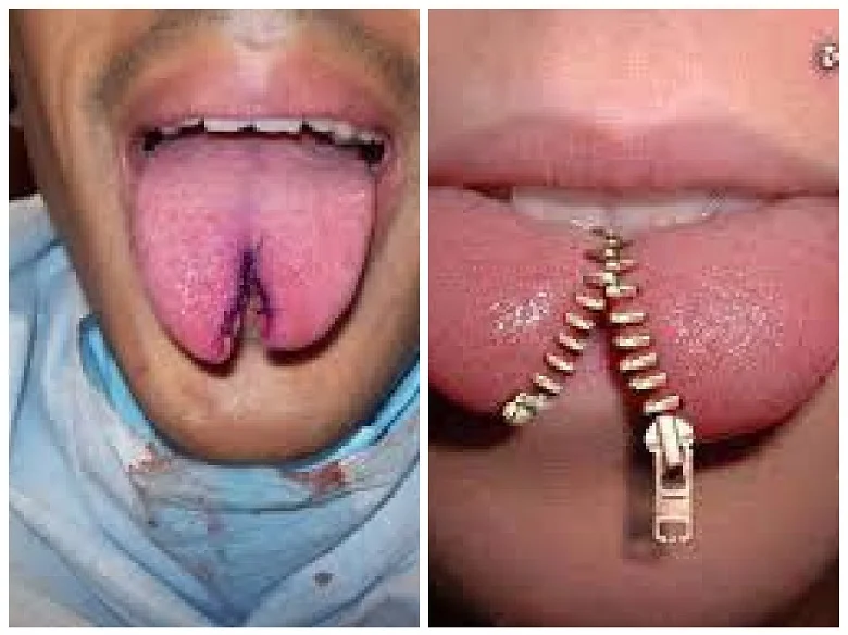 What are body modifications other than piercings and tattoos?