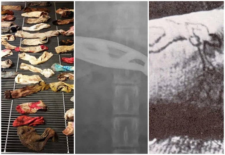 10 weirdest things found in animal stomachs