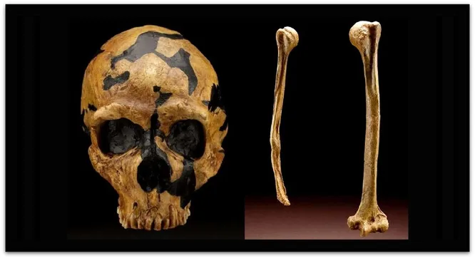 On the skull of the Shanidar-1 ("Nandi") skeleton, damage to the left cheekbone is visible, affecting the orbit. The lower part of the right humerus is missing, indicating a possible traumatic amputation