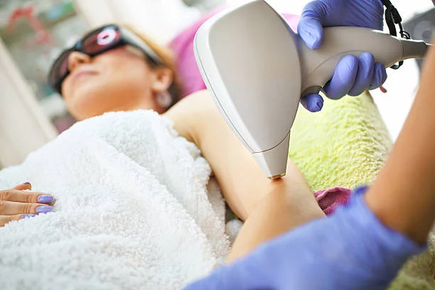 Laser hair removal: what you need to know