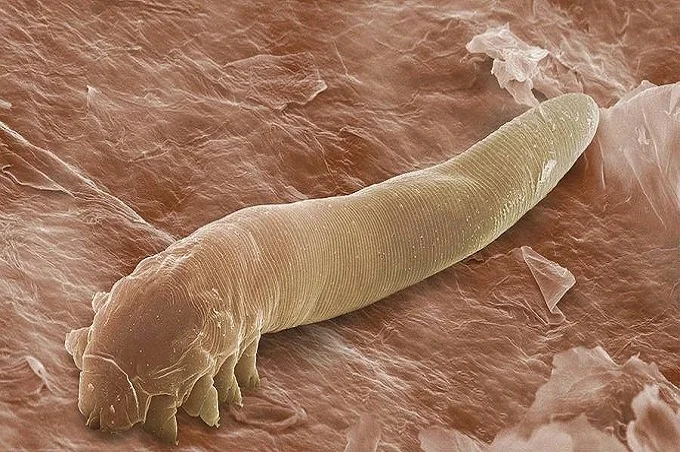10 disgusting creatures that live in your body
