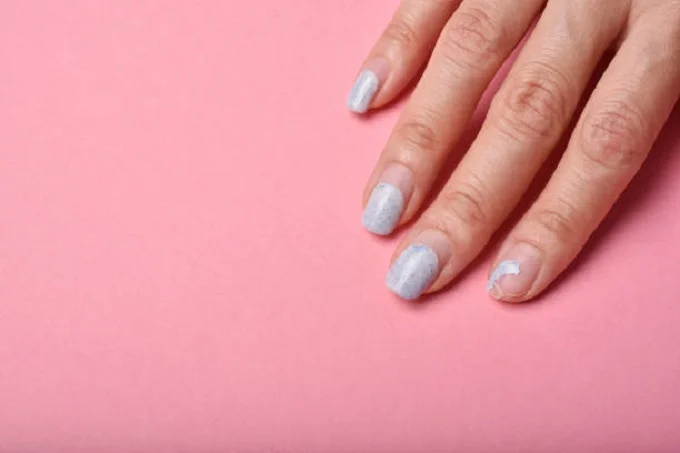 Fingernail ridges: What causes furrows on the nails, and how to get rid of them