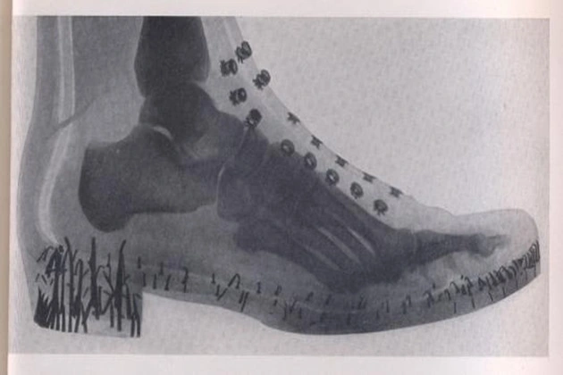 Shoe X ray