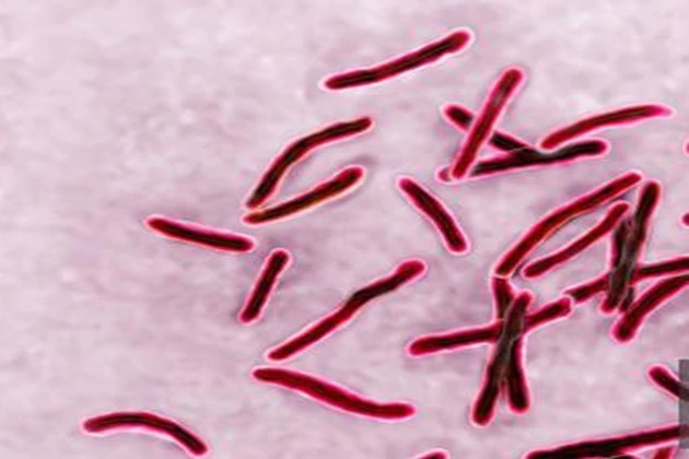The Roma body easily copes with Koch's bacillus.
